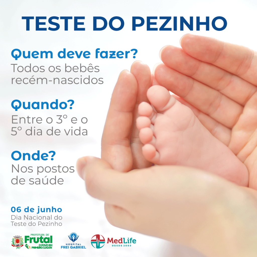 Qual A Importância Do Teste Do Pezinho Para Os Bebês Med Life 7682